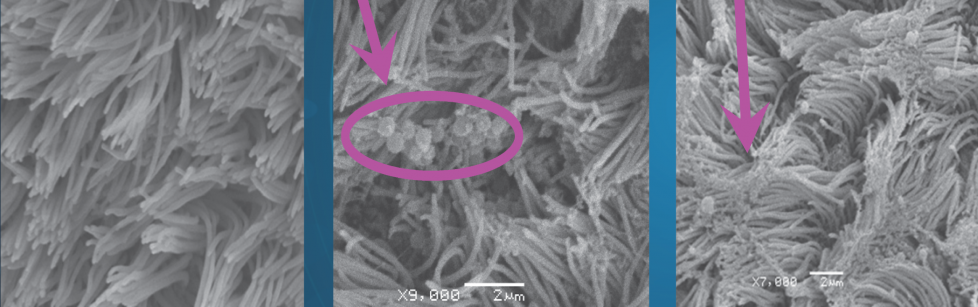 Foto links: Microscopisch beeld van normale trilharen aanwezig op de buitenste cellen van de bovenste luchtwegen; Foto midden: Aanhechting van M. hyo aan de trilharen; Foto rechts: Beschadiging van de trilharen ten gevolge van een M. hyo infectie
