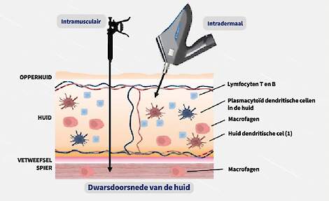 Figuur - Toediening van vaccinatie: intramusculair en intradermaal