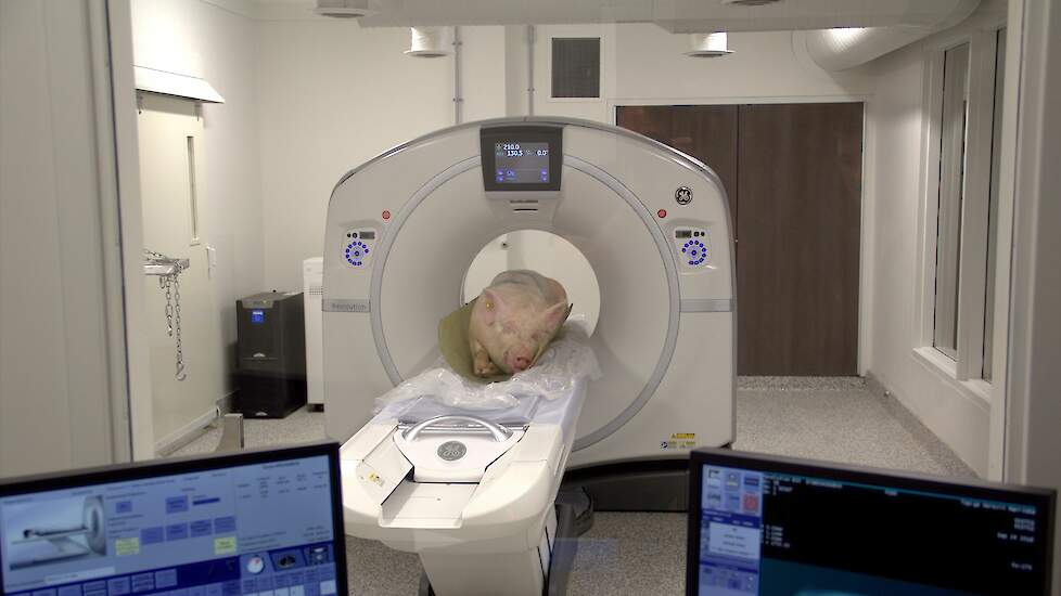 CT-scan beeld in verschillende weefseltypes waaronder bot-, spier- en orgaanweefsel